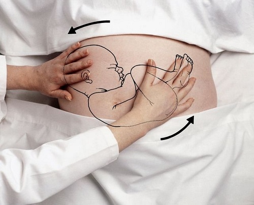 Theo thống kê thì có khoảng 4% thai nhi nằm ngôi thai ngược khi sinh ra đời